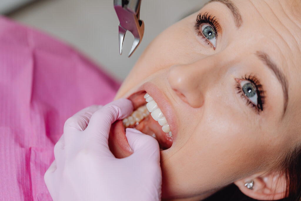 tooth extraction in Raleigh NC