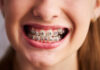 orthodontist madison ms