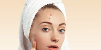 How Do I Get Rid of Pimples? Pimple